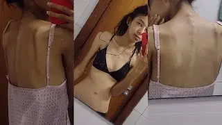 my eating disorder story with pictures and videos (trigger warning)