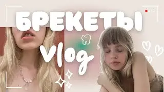 СТАВЛЮ БРЕКЕТЫ / морковный влог