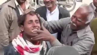 Teeth Whitening at India