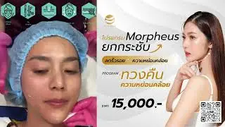 Morpheus8 เติมความมั่นใจให้ผิว ดูอ่อนกว่าวัย | KIN WELLNESS #morpheus  #morpheus8