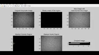 real time distance measurement and pixel count in matlab