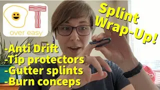Splints (Part 5) - Ulnar Drift, Hand Fractures, and Burns