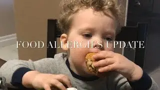 WHY I GIVE MY ALLERGIC SON EGGS // FOOD ALLERGIES // ORAL FOOD CHALLENGE