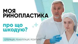 РИНОПЛАСТИКА — МІЙ ДОСВІД 