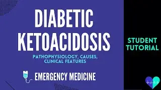 Diabetic Ketoacidosis (pathophysiology, causes, clinical features) - Medical Tutorial