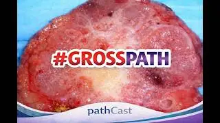 An Introduction to Gross Specimen Examination: Basic Principles 
