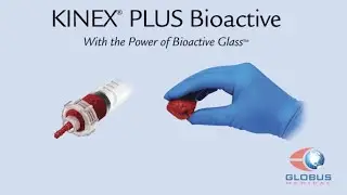 Globus Medical: KINEX® PLUS