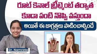 Reason For Pain After Root Canal Treatment || Root Canal Recovery Tips || Eledent Dental Hospitals