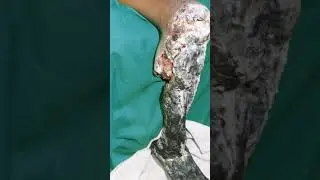 Most dangerous snake | most deadly of India and indian sub-continent | saw-scaled viper