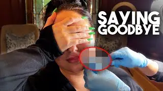 DISSOLVING ALL OF MY LIP FILLER...