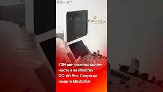 Мастер-класс по УЗИ вен нижних конечностей на Mindray DC-60 Pro. Скоро на 