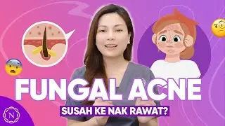 Beauty Tips || Fungal Acne