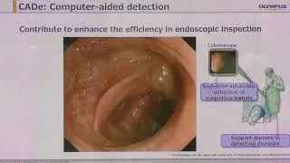 03 Kazuhiro Gono What the smart endoscope should be able to do