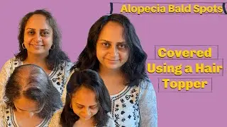 Alopecia Bald Spots covered using Sans Couture Hair Topper | Nish Hair