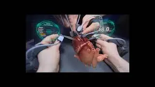 Application VR in Surgery [THE GOOD DOCTOR EPISODE 9]