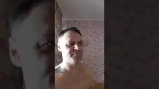 КАМЕНЬ В ПОЧКАХ,ОКСОЛАТЫ,УРАТЫ.ЧЕМ ОБЕЗБОЛИТЬ ПРИСТУП.