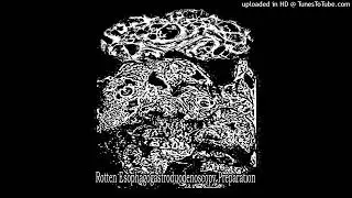 Uvulopalatopharyngoplasty - Rotten Esophagogastroduodenoscopy preparation (full demo)