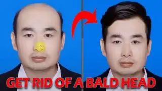 #shorts Get rid of a bald head || Photoshop