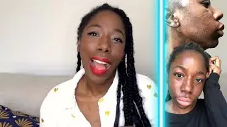 ROACCUTANE, LA solution finale ? (je douille) || FIL&DIA