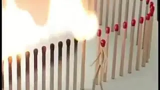 Xxxz
