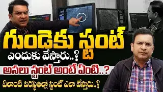 Dr Movva Srinivas About గుండెకు చేసే స్టంట్ అంటే ఏంటి - About Heart Stents in Angiogram Demo || SMH