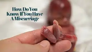 How Do You Know If You Have A Miscarriage | Symptoms | Signs and Causes