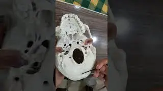 skull model | norma basil's |inferior of skull | part 4
