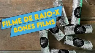 Filme de Raio-x Bones Films