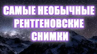 Самые Необычные Рентгеновские Снимки