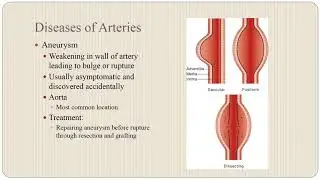 Cardiac Part 2