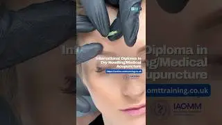 Advanced MSK Techniques: Frontalis Dry Needling Demo 