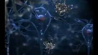 Neuron Destruction Animation