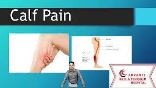 Calf Pain : Cause, Prevention and Treatment