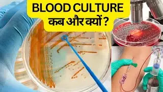 Blood Culture