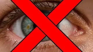 Do not watch! If you do clean your eyes with bleach.
