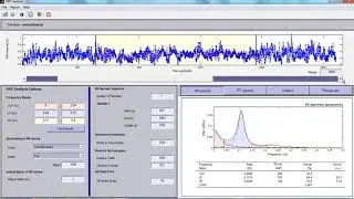 ECG and HRV Analysis Matlab Projects | ECG and HRV Analysis Matlab Thesis
