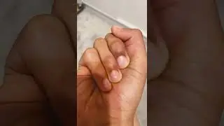 How many fingers? #shorts #viral