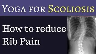Yoga for Scoliosis - 4 exercises to reduce rib pain