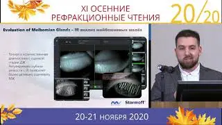 Комплексное исследование переднего отрезка глаза: 7 показателей за 5 минут – Карамышев П. Б.