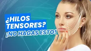 ¿Te pusiste hilos tensores  Sigue estos cuidados esenciales? / Odontoespecialistas