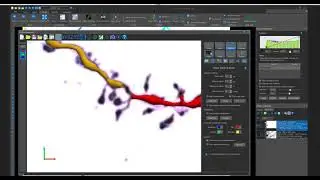 Webinar: Optimizing Dendritic Spine Detection and Classification (Part 1)