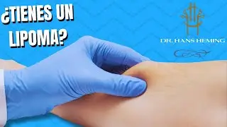 ¿Qué es un Lipoma y cuándo deberías preocuparte?