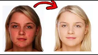Photoshop tutorial: Skin Retouch