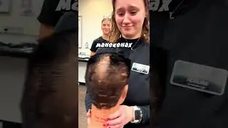 Get a haircut that will hide your bald spot 😃