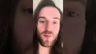 Do I have pretty eyes? Are my eyes rare?