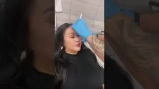 Tracy Tries Dysport with a Master Injector at Novuskin! | Wrinkle Smoothing Treatment Results