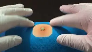 Treatment Of Blackhead Removal at Lam Dep Spa #044
