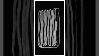 Tapeworms and what to eat them with 🤤