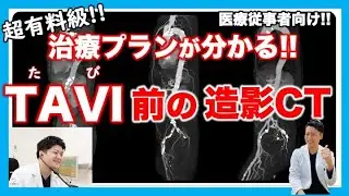 TAVI治療プラン　造影CTの威力 TAVI（Transcatheter Aortic Valve Implantation) の穿刺部位、人工弁の選択　上嶋亮先生　かみじま内科クリニック