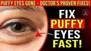 Get Rid of Puffy Eyes for Good with Dr. Lab – The Secret Celebs Use!